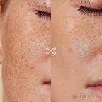 Niacinamida 20% Kit Adios Manchas