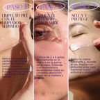 Niacinamida 20% Kit Adios Manchas